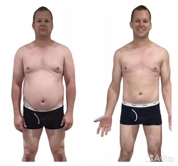 Антицеллюлитный массаж, lpg, похудение, эпиляция л