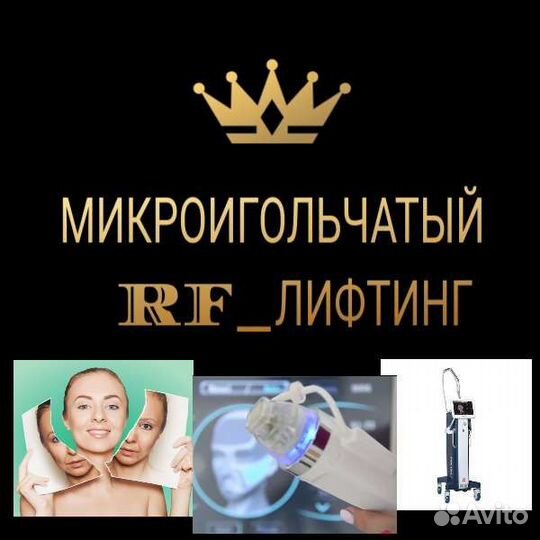 Микроигольчатый RF лифтинг лицо