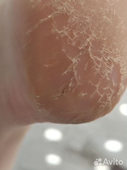 Услуги подолога