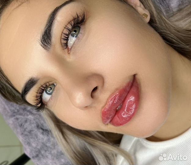 Увеличение губ, контурная пластика лица