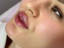 Увеличение губ контурное увеличение губ