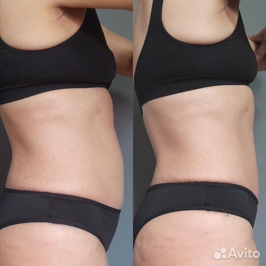 Массаж сферами (компрессионный вибрационный)