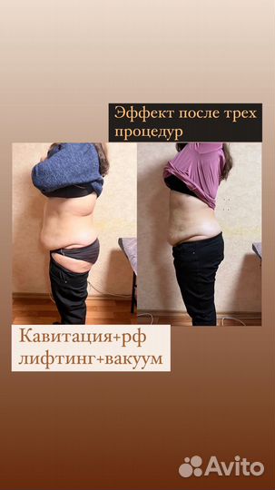 Снижение веса