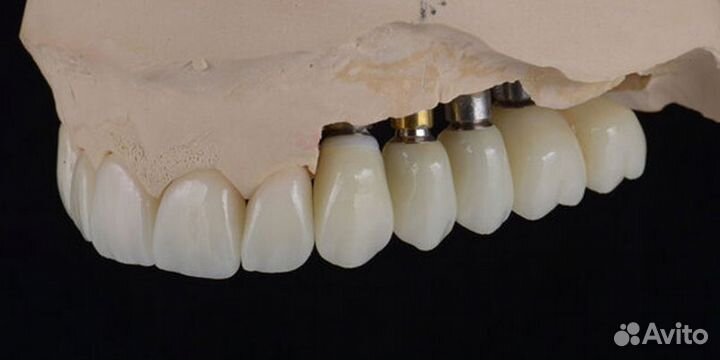 Фрезеровка циркония и 3D моделирование