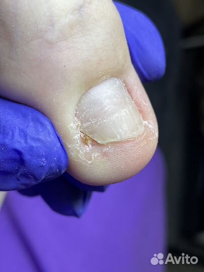 Курсы обучение маникюру, педикюру