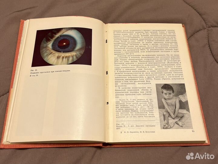 Наследственные болезни обмена веществ у детей