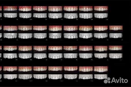 Реплика набора зубов Яна Хайто