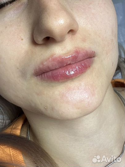 Услуги косметолога г. Буденновск