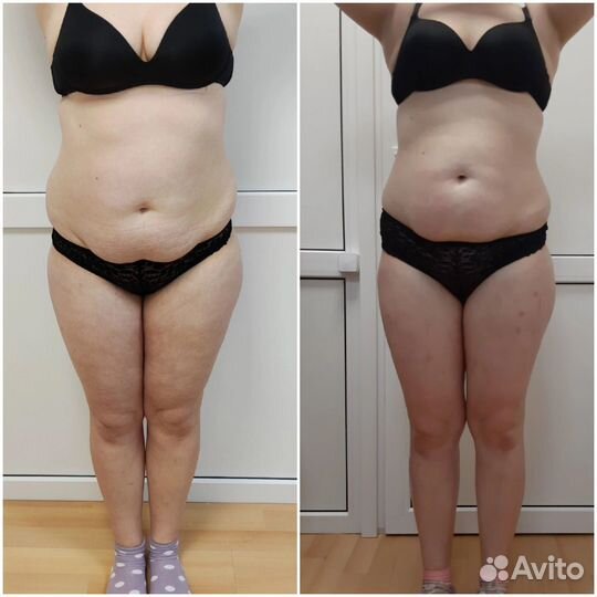 Требуются модели по коррекции фигуры и похудению