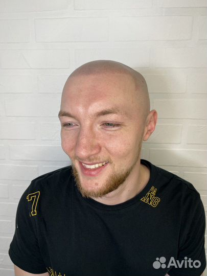 Трихопигментация по методу SMP