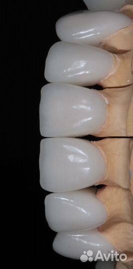 Коронки цирконевые, виниры, зубы на имплантах