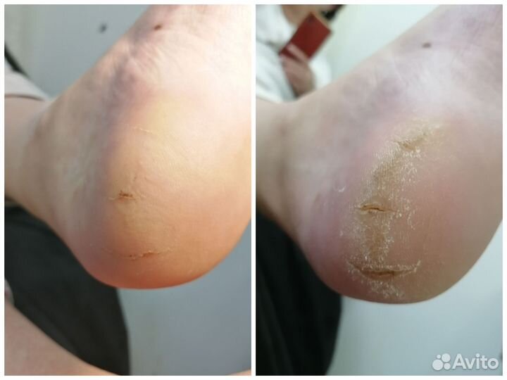 Мастер маникюра