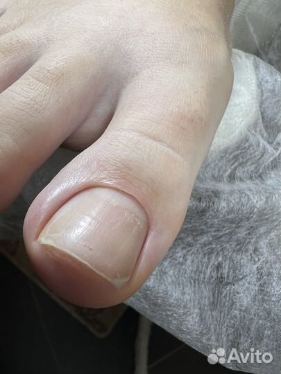 Модель на педикюр / Бесплатно