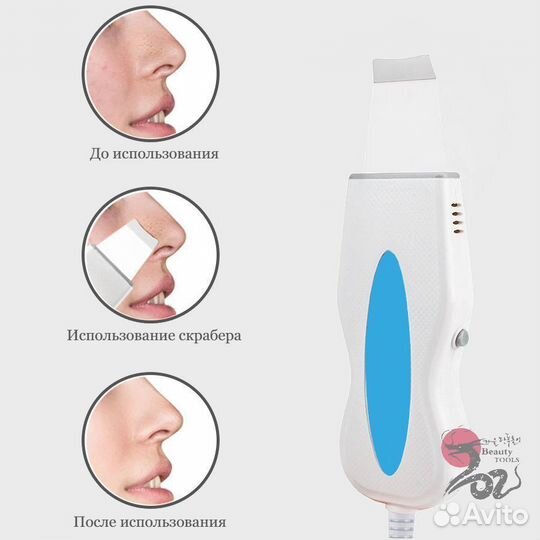 Аппарат для УЗ чистки лица. Ультразвуковой скрабер