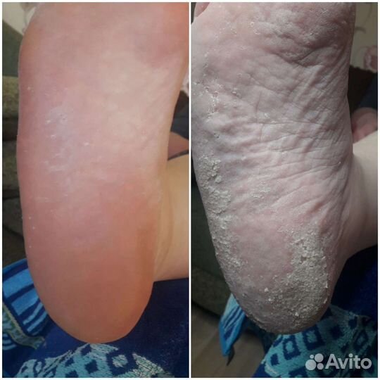 Маникюр, педикюр