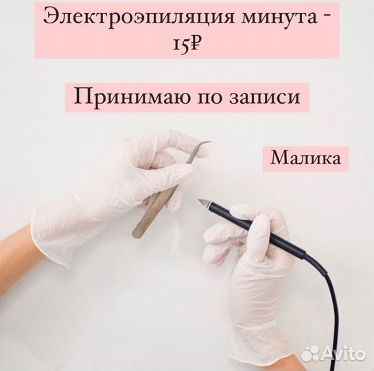 Электроэпиляция