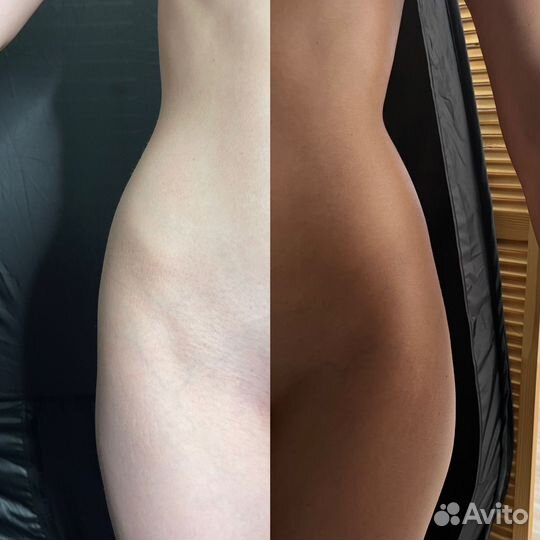 Моментальный загар (Северный)