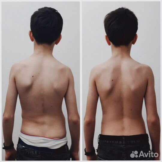 Массаж мануальный костоправ массажист