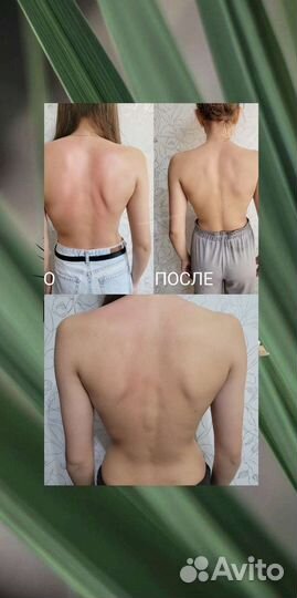 Лечебный массаж