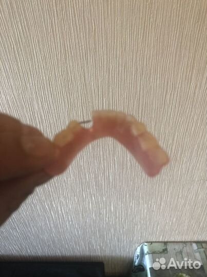 Ремонт акриловых съёмных зубных протезов