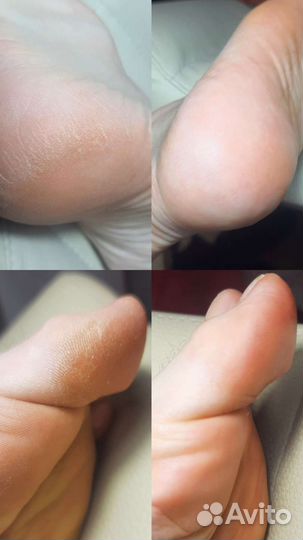 Педикюр (смарт) маникюр, покрытие гель лак