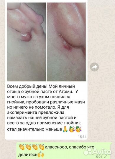 Зубная паста атоми