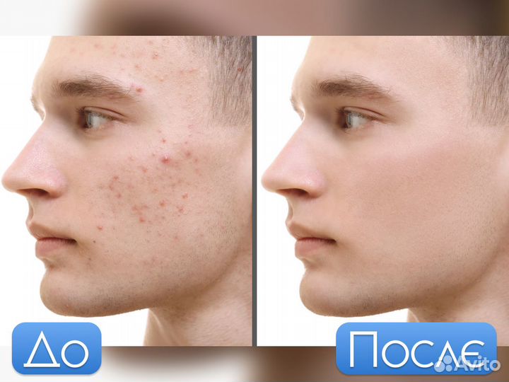 Ретушь и обработка фотографий в Photoshop