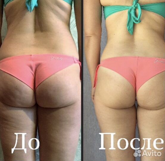 Массаж Анапа