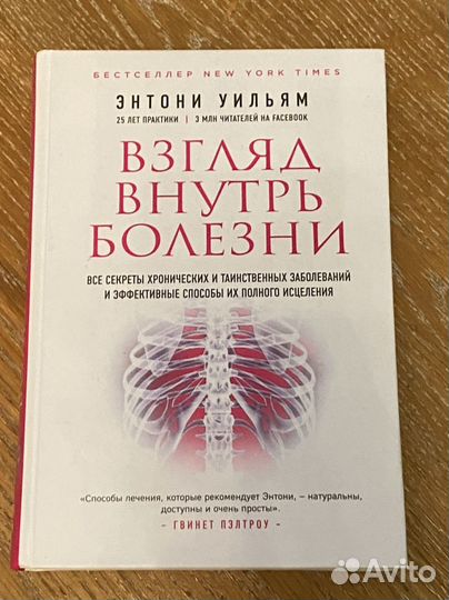 Книга взгляд внутрь болезни Энтони Уильям