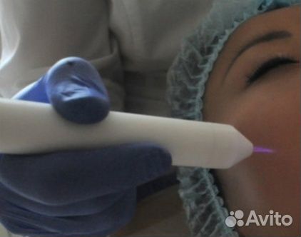 Врач косметолог. Холодная плазма. Пилинг