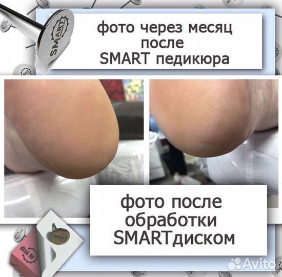 Маникюр, педикюр, мап, Скобы, smart-педикюр