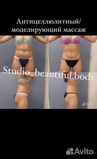 Антицеллюлитный массаж,LPG массаж