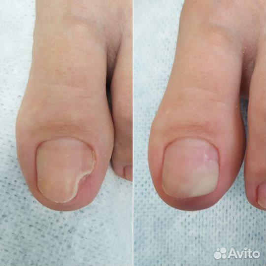 Услуги подолога