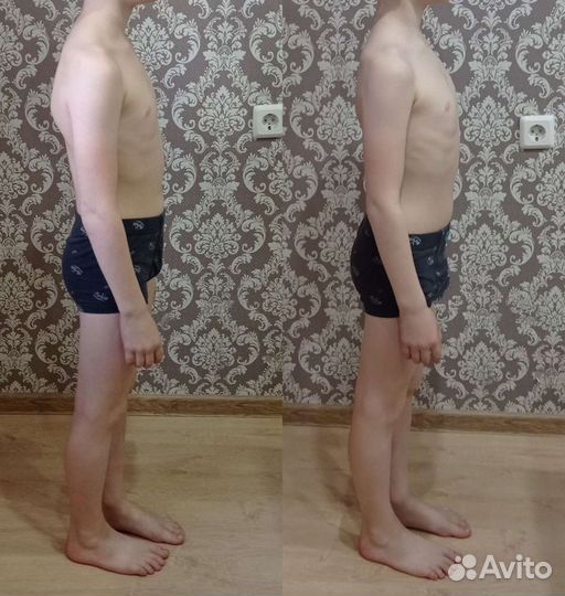 Оздоровление организма (коррекция осанки, работа с