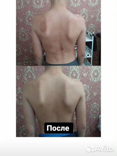 Альтернативная медицина