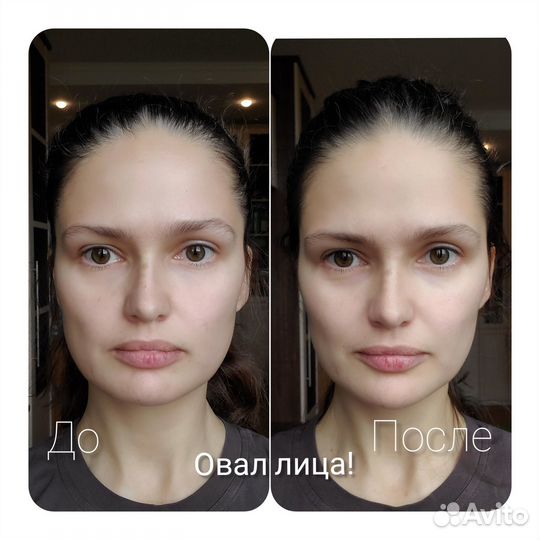 Прикладная кинезиология. Коррекция родовой травмы