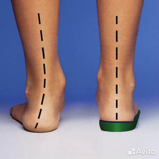 Ортопедические стельки на заказ