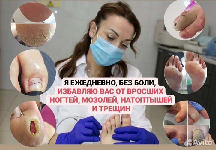 Педикюр подолог