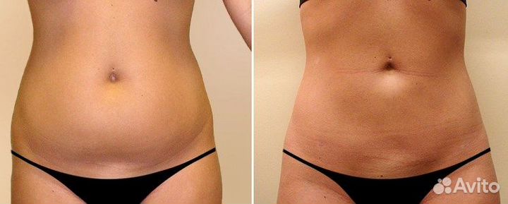 Модели на Кавитация Живота