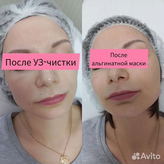 Услуги косметолога