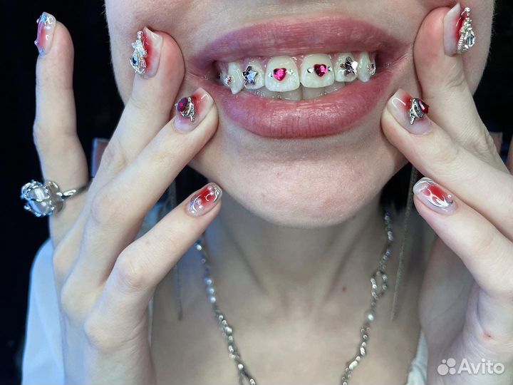 Установка скайсов (кристаллов/страз на зубы)