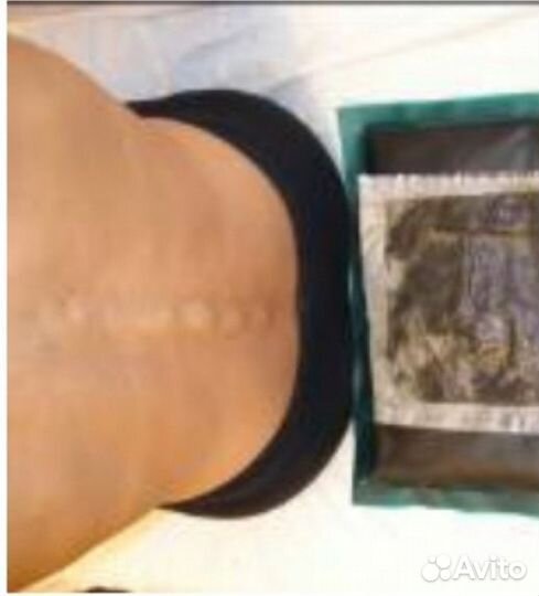 Лечебная грязь