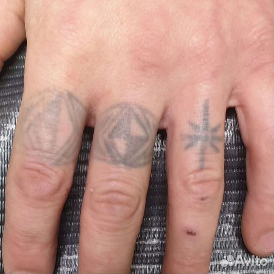 Лазерное удаление тату и татуажа