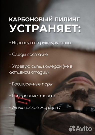 Карбоновый пилинг