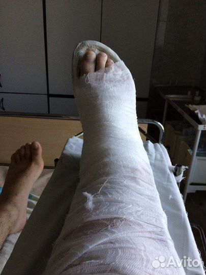 Гироскутер