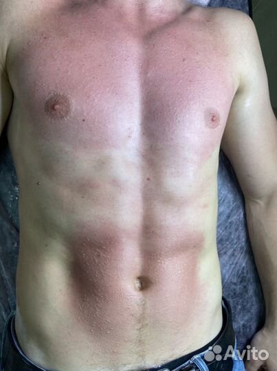 Восковая/сахарная депиляция/эпиляция/шугаринг