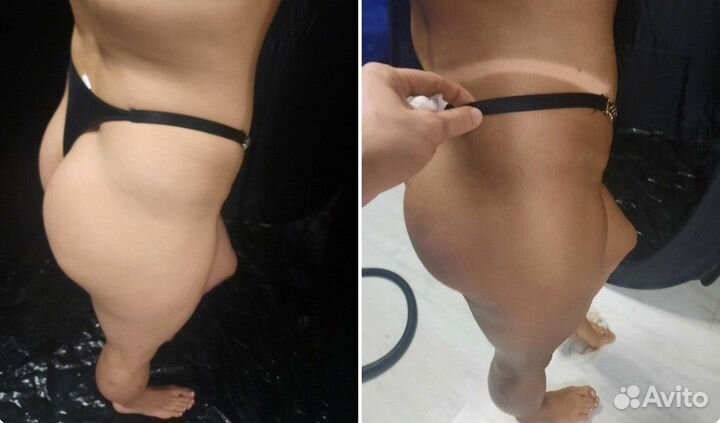 Моментальный загар