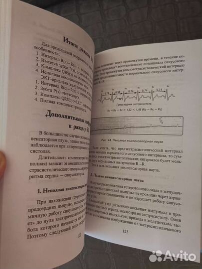 Учебник по медицине. экг