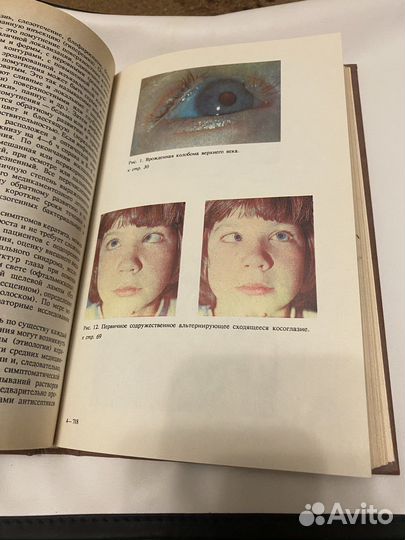 Офтальмология учебная литература