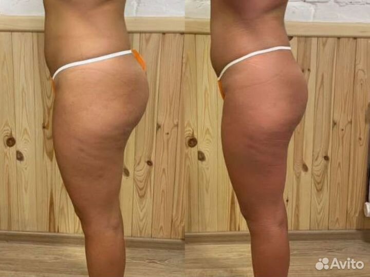 Ручной массаж